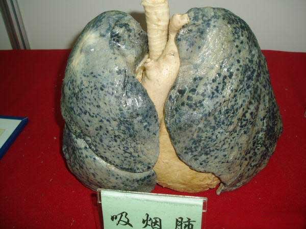 抽烟的人如何清肺 6种食物来帮你