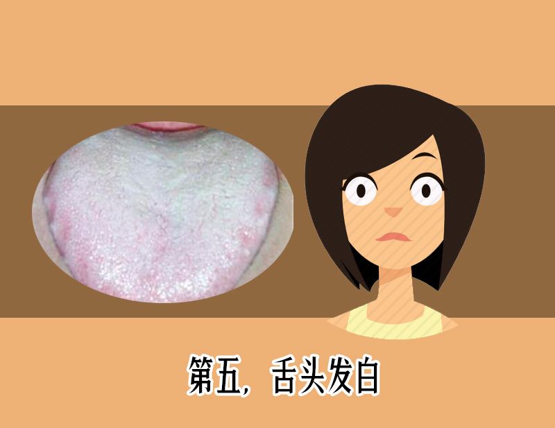 舌苔厚白是怎么回事？